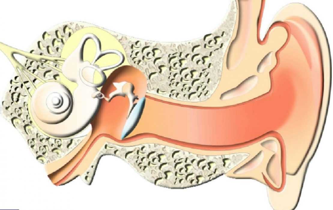 Причины воспаления среднего уха. Острый Гнойный средний отит. Средний отит среднего уха. Острый катаральный отит.