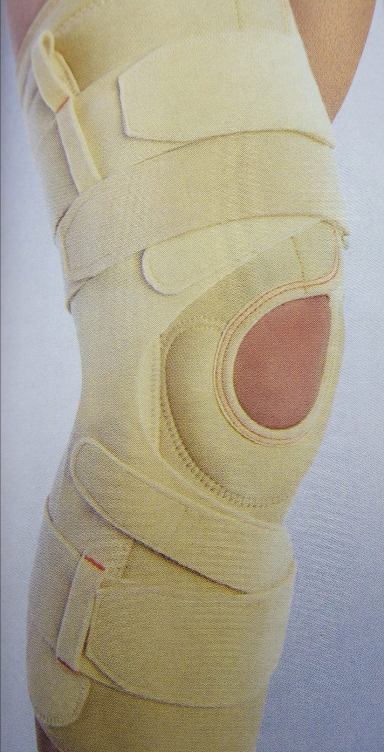 Лечение артроза коленного сустава. Начальные симптомы гонартроза