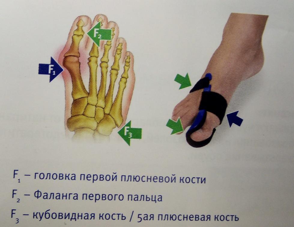 Болит фаланга указательного пальца ноги